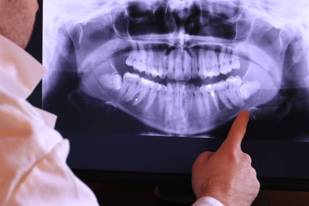 Best Knocked-Out Tooth Emergency  in Lockwood, MT
